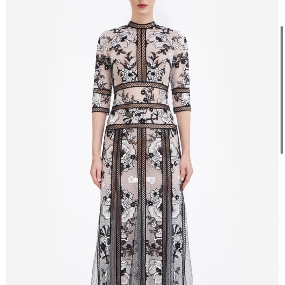 Chic Black and White Lace Dress
